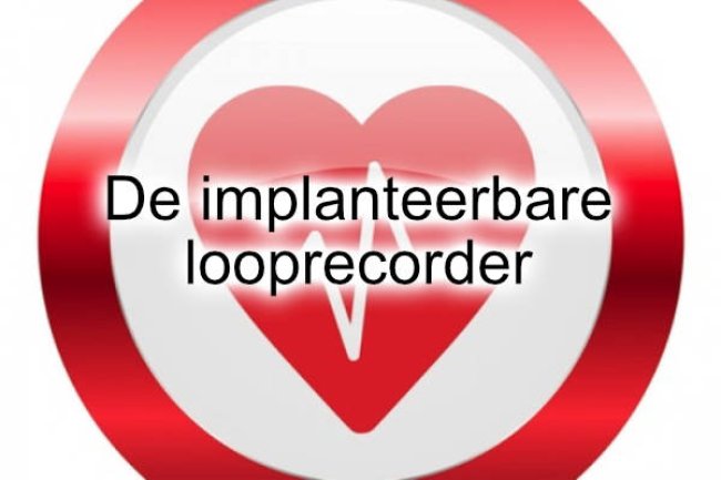 De implanteerbare looprecorder
