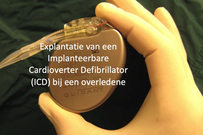 ICD protocol postmortum explantatie