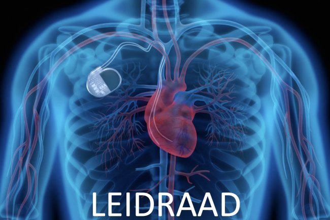 Leidraad CIED implantatie