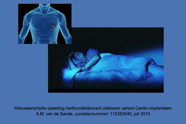 Diagnostiek van gestoorde ademhalingen in een pacemaker, zinvol?