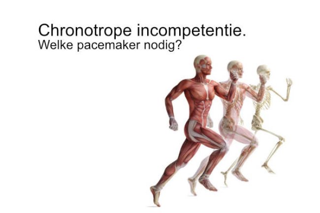 Chronotrope incompetentie. Welke pacemaker nodig?