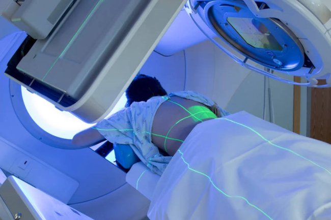 Herziene Richtlijn RadioTherapie 2024